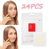 24PCS Acne Remover Treatment Cream Blackhead Remover